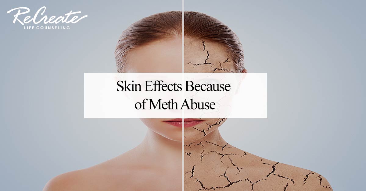 Skin Effects Because of Meth Abuse